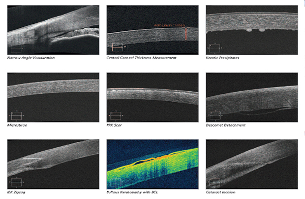 Diagnostic | Natandeep Eye Hospital