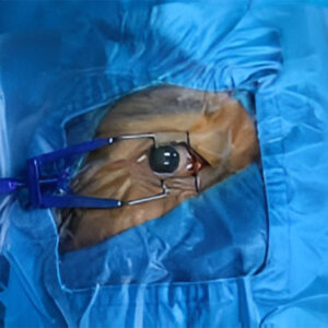 lasik & refractive surgery