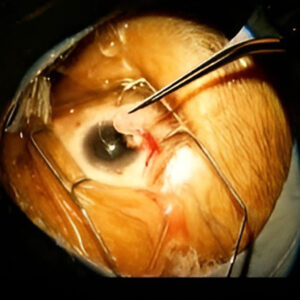 orbit & oculoplasty surgery
