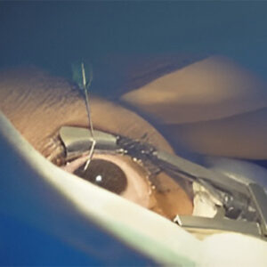 orbit & oculoplasty surgery2